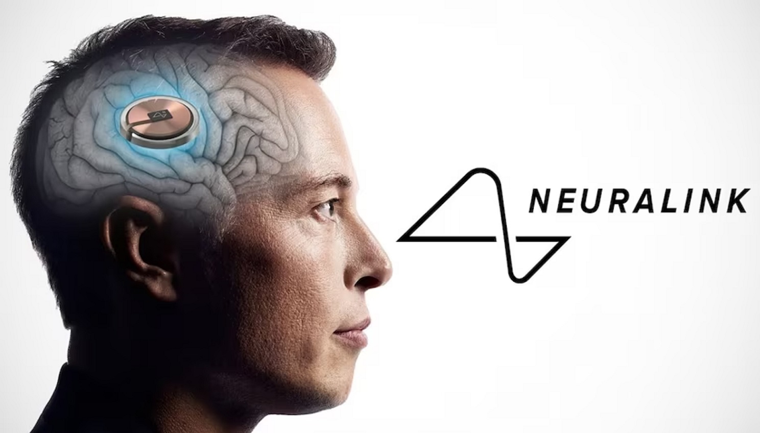 Илон Маск анонсировал новый чип Neuralink, возвращающий людям зрение